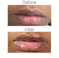 Pink Lip Treatment Kit